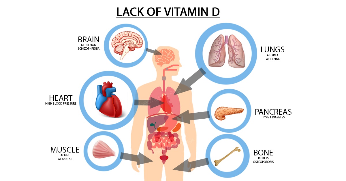 vitamin D and health